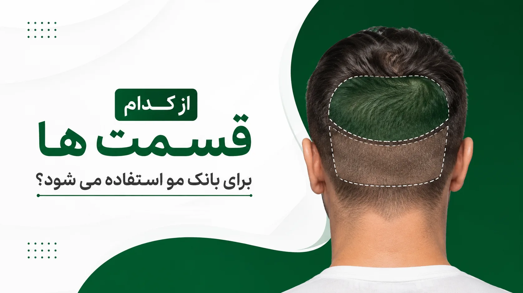 از کدام قسمت ها برای بانک مو استفاده می شود؟